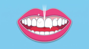 Boca abierta de labios rosados con dientes blancos y destellos brillantes sobre fondo azul.