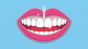 Cómo blanquear los dientes de forma segura y qué evitar para no mancharlos, según odontólogos