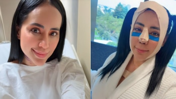 ¿Qué le pasó a Sandra Cuevas? La exalcaldesa reapareció con el rostro vendado tras someterse a una cirugía