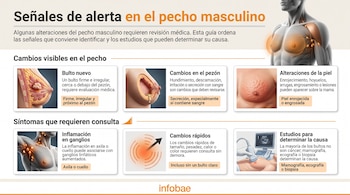 Infografía con textos, ilustraciones anatómicas del torso masculino y recuadros explicativos sobre síntomas mamarios y ecografías.
