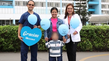 Médicos reducen malformación congénita que deformaba el rostro de un niño de tres años