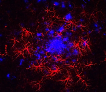 La neurociencia reconoció que los