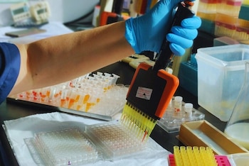 Con una producción anual de hasta 800.000 dosis, el centro del INTA Rafaela fortaleció sus instalaciones para potenciar una vacuna clave contra la tristeza bovina