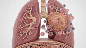 Un hallazgo clave podría mejorar