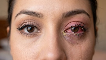 Lifting, extensiones y delineador: ¿Qué riesgos oculares esconden estos preocedimientos de belleza?