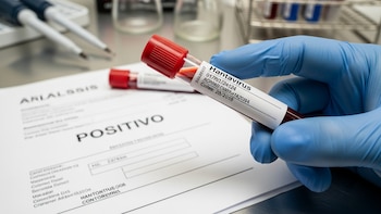 Hantavirus en Argentina: la letalidad alcanzó un récord histórico en la temporada 2025-2026