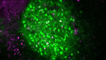 Las neuronas IPACL CRF (en