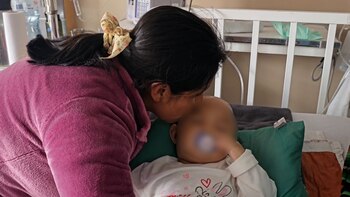 Médicos del Cusco reconstruyen el