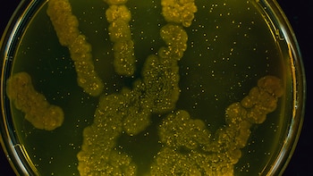 Para este 5 de mayo, la OPS impulsa la jornada bajo el lema: “Juntos, podemos acelerar la acción para prevenir infecciones y resistencia a los antimicrobianos en la atención de la salud y construir una cultura de seguridad y calidad en la cual a la mejora de la higiene de las manos se le da alta prioridad" / (Getty Images)