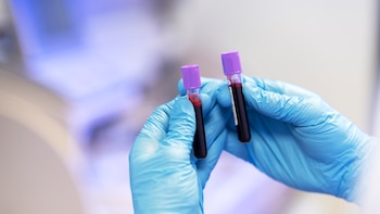 La prueba de sangre que detecta cuatro tipos de cáncer y podría revolucionar los diagnósticos actuales