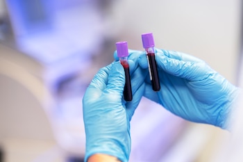 Muestras de sangre (Freepik)