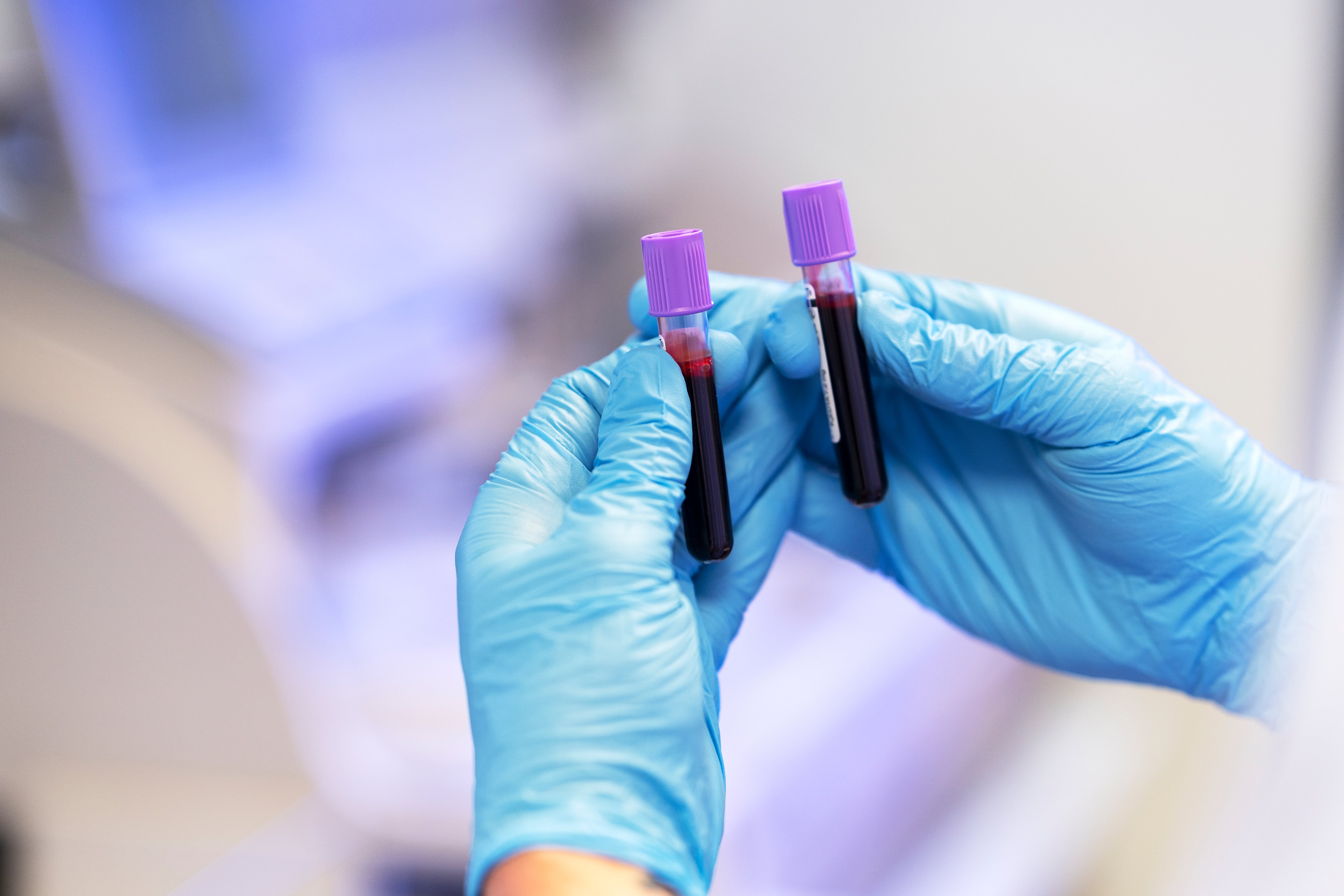 Investigadores de la Universidad McGill logran crear coágulos artificiales en cinco segundos para frenar hemorragias internas graves. (Freepik)