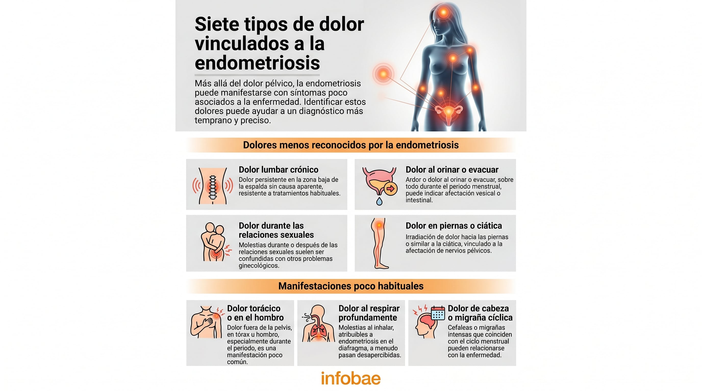 Una infografía ilustra los siete tipos de dolor, algunos poco reconocidos, asociados con la endometriosis en diferentes partes del cuerpo. (Imagen Ilustrativa Infobae)