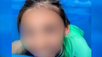 Tragedia en Escobar: una joven con discapacidad estuvo 30 minutos en una pileta terapéutica y murió ahogada; denuncian abandono