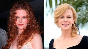 Nicole Kidman no podía mover