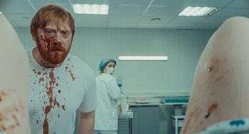 Hombre de cabello y barba rojizos con sangre en el rostro y la camiseta. De fondo, una mujer con gorro y mascarilla y equipo médico de hospital