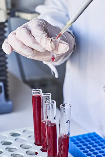 Mano enguantada con pipeta transfiere líquido rojo a un microtubo. Tres tubos de ensayo con líquido rojo en un soporte blanco y un soporte azul en el fondo