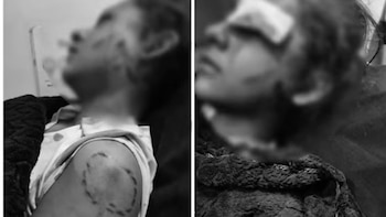 Menor fue brutalmente atacada en