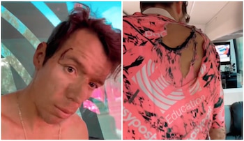 Rigoberto Urán mostró cómo quedaron