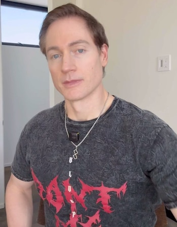 Bryan Johnson, el influencer biohacker que quiere vivir 160 años, recibió el diagnóstico de una enfermedad incurable