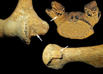 Ilustración de los cambios esqueléticos