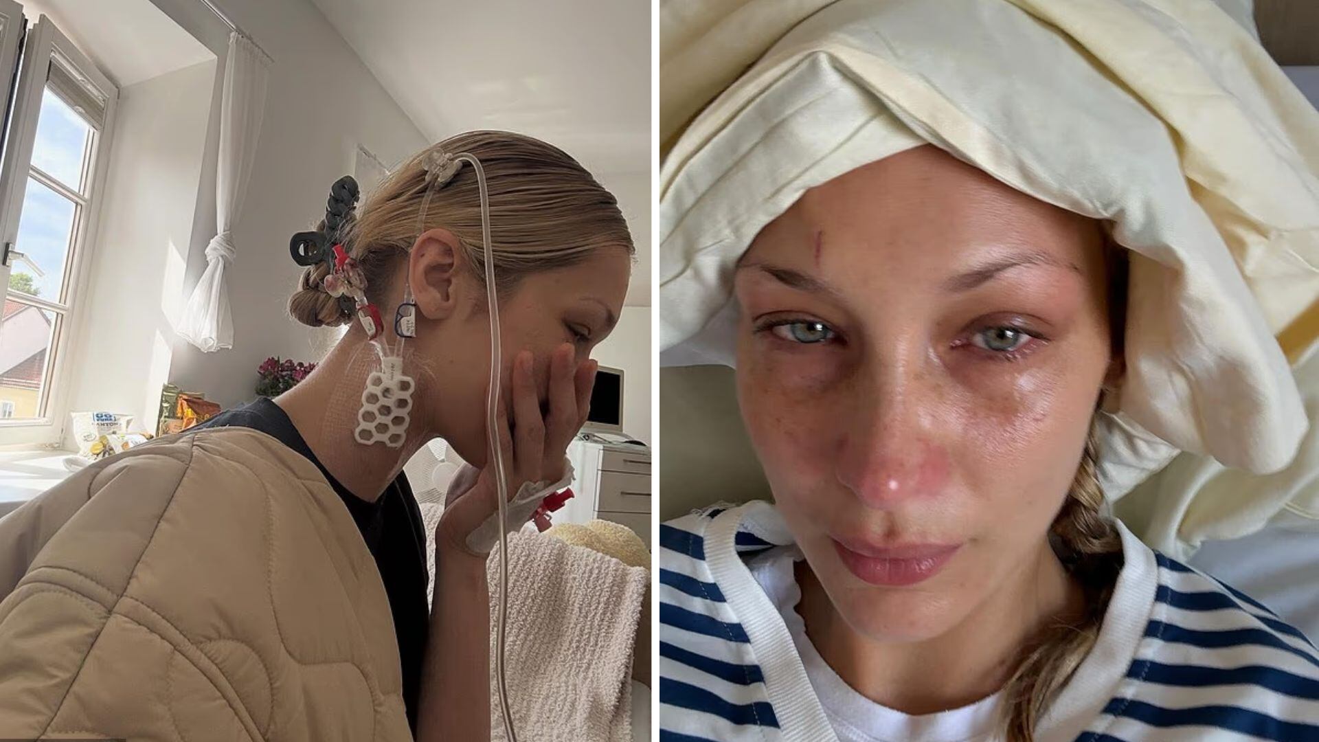 Bella Hadid compartió fotos desde el hospital durante su enfermedad (Instagram/Bella Hadid)