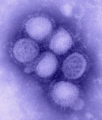 Micrografía en tonos violetas con seis estructuras virales esféricas y bordes espiculados sobre un fondo granulado