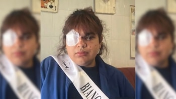 Estado en el que quedó Bianca Lizbeth Fernández tras la paliza. (Bianca Fernández)