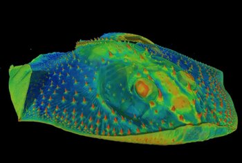 Investigaciones relacionan la sensibilidad dental
