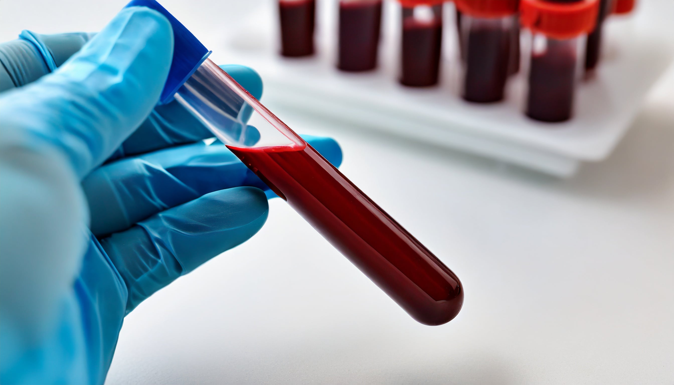 El estudio advierte que el uso prolongado de corticosteroides puede causar efectos adversos en la salud (Imagen Ilustrativa Infobae)