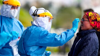 COVID-19: es imposible conocer con