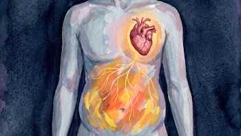 El tamaño del abdomen importa: un estudio advierte que la adiposidad central aumenta el riesgo de infarto y ACV