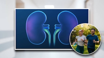 Esta es la amanera correcta