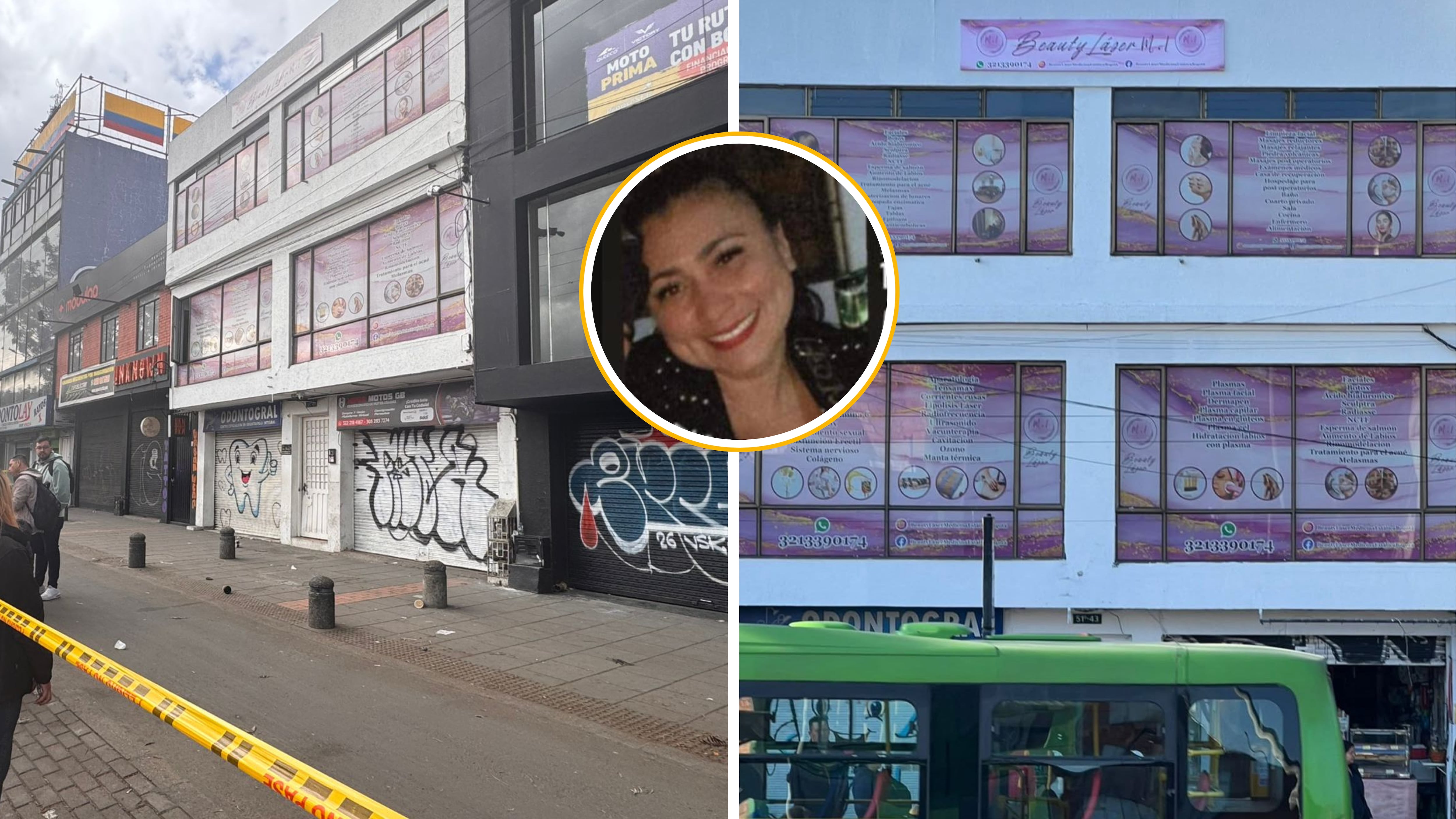 Pacientes del centro estético revelaron inconsistencias en los procediminetos - crédito Bosa A7, @Maurvan/X y Beauty Láser Estética