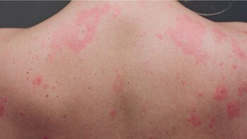 Por qué cerca del 20%