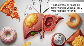 Ilustración de un hígado graso con un reloj al fondo, rodeado de una porción de pizza, dos donas, una lata de refresco y una bolsa de papas fritas.
