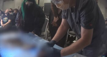 Imágenes de la autopsia pública