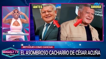 ¿Qué se habría hecho César Acuña en el rostro? Magaly Medina reacciona y especialistas analizan su apariencia. Captura: Magaly TV La Firme.
