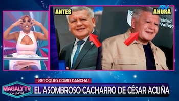 César Acuña sorprende por sus retoques faciales y Magaly Medina lo critica: “De terror. Le hicieron una monstruosidad”