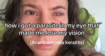 La joven perdió la vista