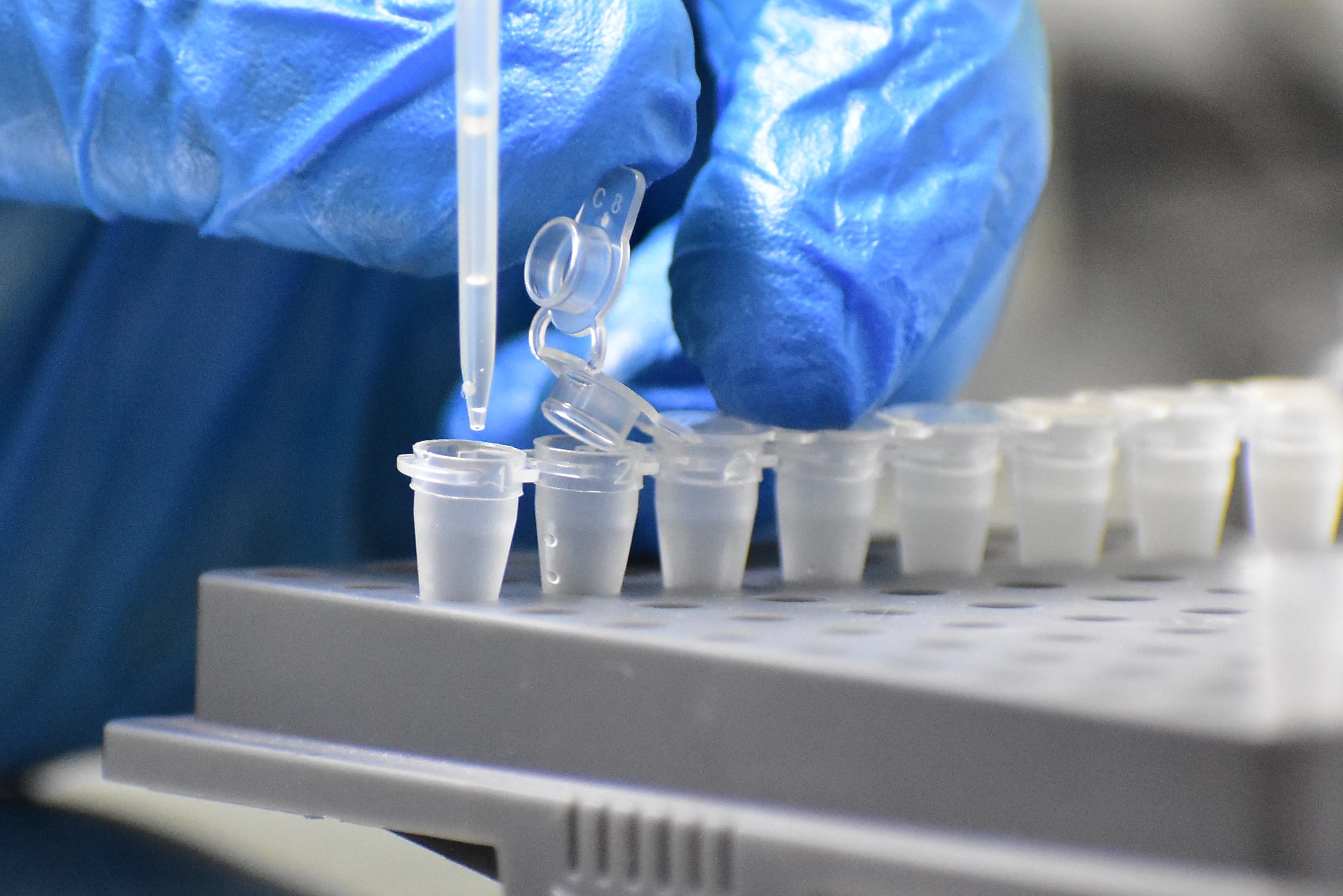 La caracterización molecular del linfoma de Hodgkin puede mejorar el diagnóstico y abrir paso a terapias más específicas, aunque el costo del tratamiento sigue siendo alto en El Salvador./ (Infobae Centroamérica/Emerson Del Cid)