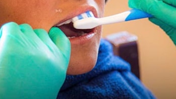 El problema silencioso que podría afectar el desarrollo de tus hijos: infecciones bucales agravan la anemia infantil