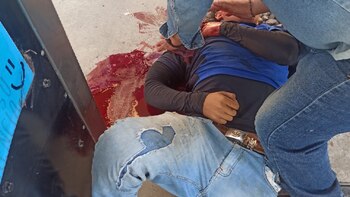 (Foto: Twitter/@VOZDEUNCHILANGO)