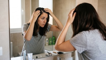La caspa y la dermatitis seborreica: dos afecciones del mismo espectro con tratamientos distintos
