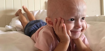 Alexandra Peraut, la única niña de España con progeria (Cedida)