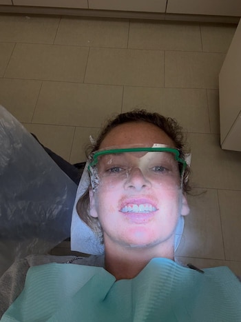 Mujer con gafas protectoras verdes y babero azul, con la boca abierta mostrando los dientes, en una clínica dental