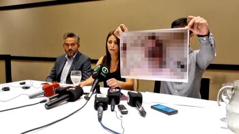 Las imágenes fueron exhibidas en