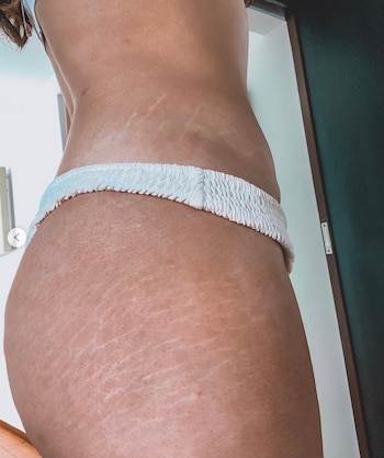 Rozanna Purcell, Miss Universo Irlanda,