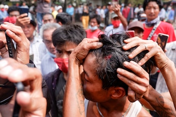Un hombre muestra una herida