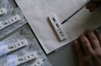 De acuerdo con estudio serológicos,